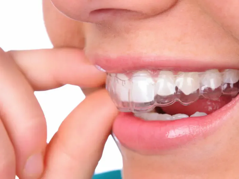 Orthodontics — 2